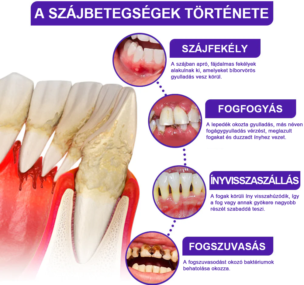 🦷 Οδοντόκρεμα με δηλητήριο μέλισσας -Φροντίστε τα δόντια σας φυσικά με τη δύναμη της μέλισσας!🐝✨