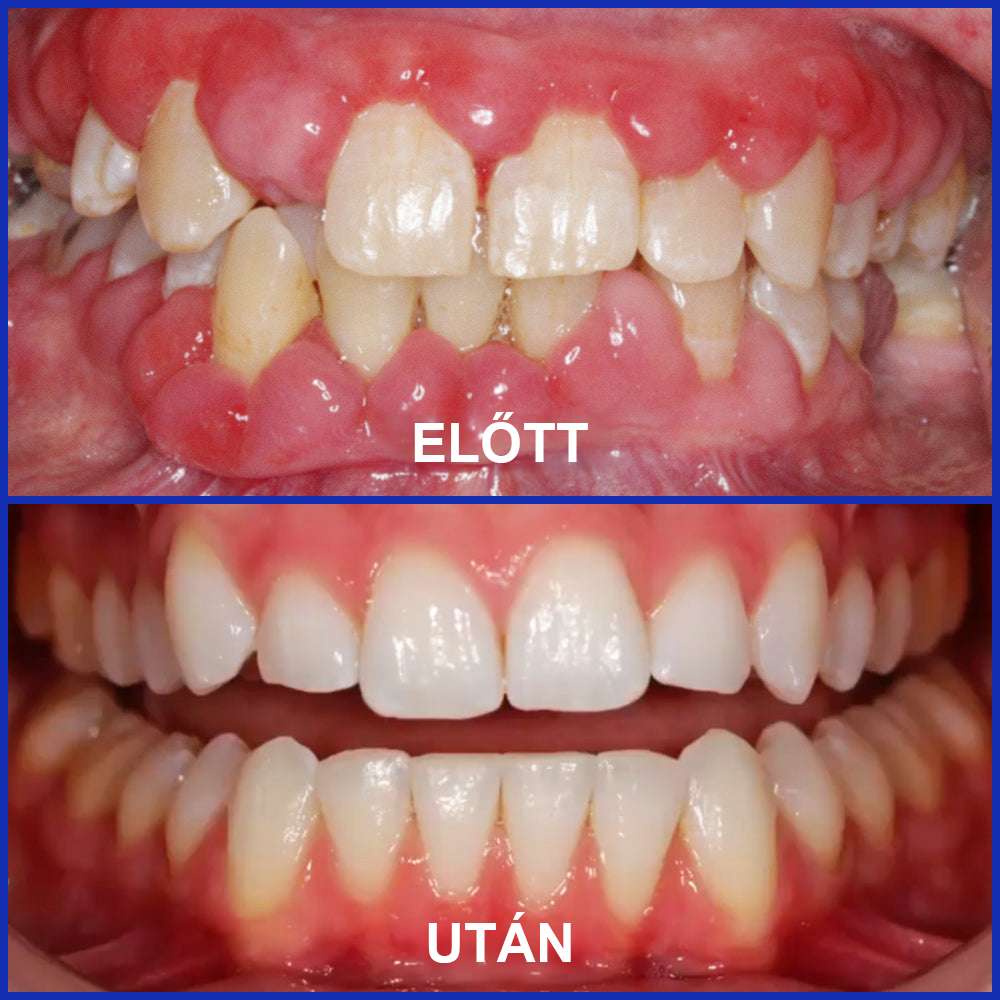 🦷 Οδοντόκρεμα με δηλητήριο μέλισσας -Φροντίστε τα δόντια σας φυσικά με τη δύναμη της μέλισσας!🐝✨
