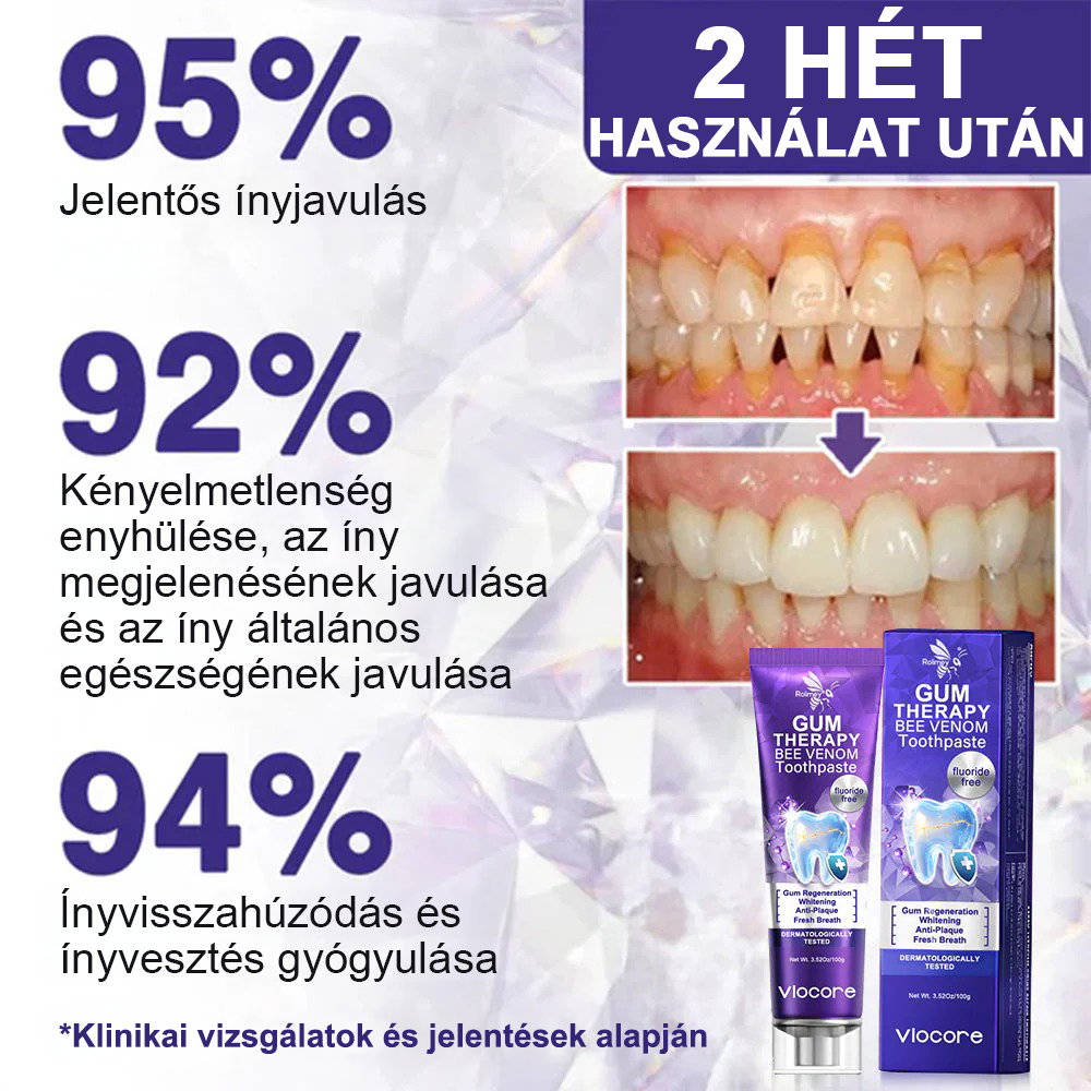 🦷 Οδοντόκρεμα με δηλητήριο μέλισσας -Φροντίστε τα δόντια σας φυσικά με τη δύναμη της μέλισσας!🐝✨