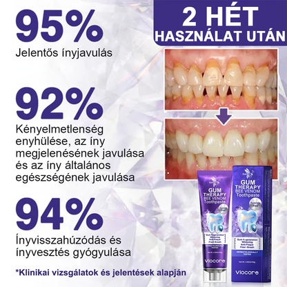 🦷 Οδοντόκρεμα με δηλητήριο μέλισσας -Φροντίστε τα δόντια σας φυσικά με τη δύναμη της μέλισσας!🐝✨