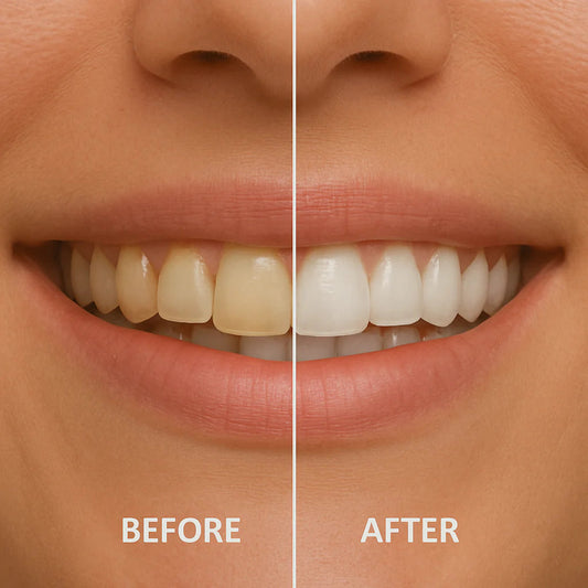 Οδοντόκρεμα με νανο-υδροξυαπατίτη που αναπτύχθηκε από τη NASA – ενισχύει το σμάλτο, αναδομεί, προστατεύει και λευκαίνει φυσικά χωρίς ερεθισμούς.