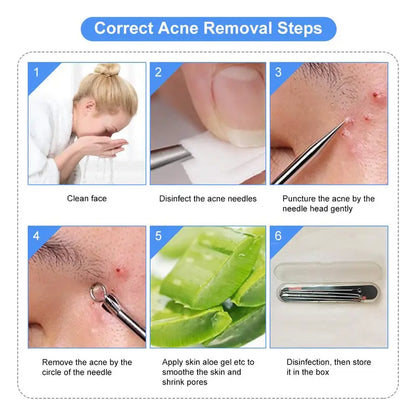 Σετ καθαρισμού προσώπου από γερμανικό κράμα τιτανίου ✨ ανοξείδωτο ατσάλι