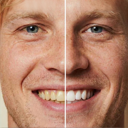 ✨ Οδοντόκρεμα για άμεσο λεύκανση των δοντιών — Τα αποτελέσματα είναι ορατά αμέσως! Συσκευασία 5 ml, μεγάλη διάρκεια ζωής! 😁🦷